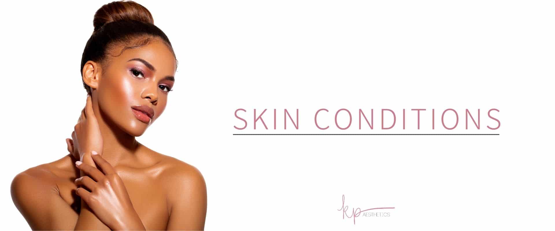 skinconditions_newtownsquare,pa_kpaesthetics