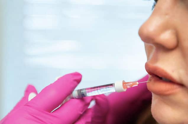 KP Aesthetic expert injector injects filler to patients lips.