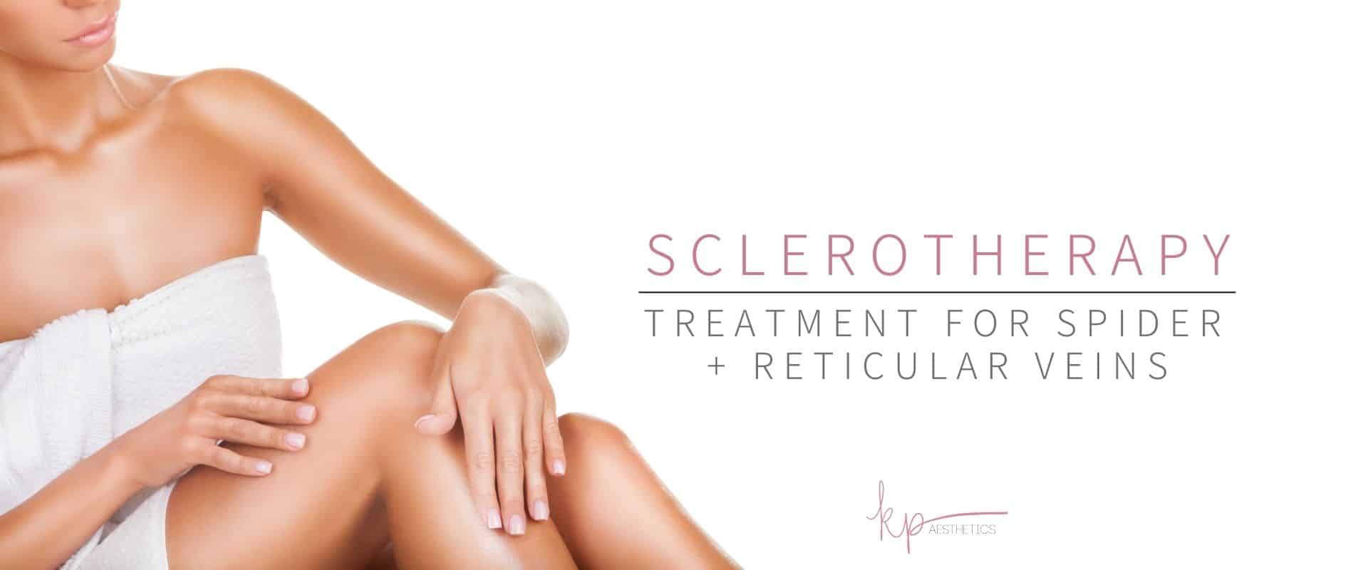 sclerotherapy treatment for spider veins.