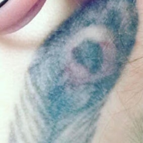 Tattoo before laser tattoo removl.