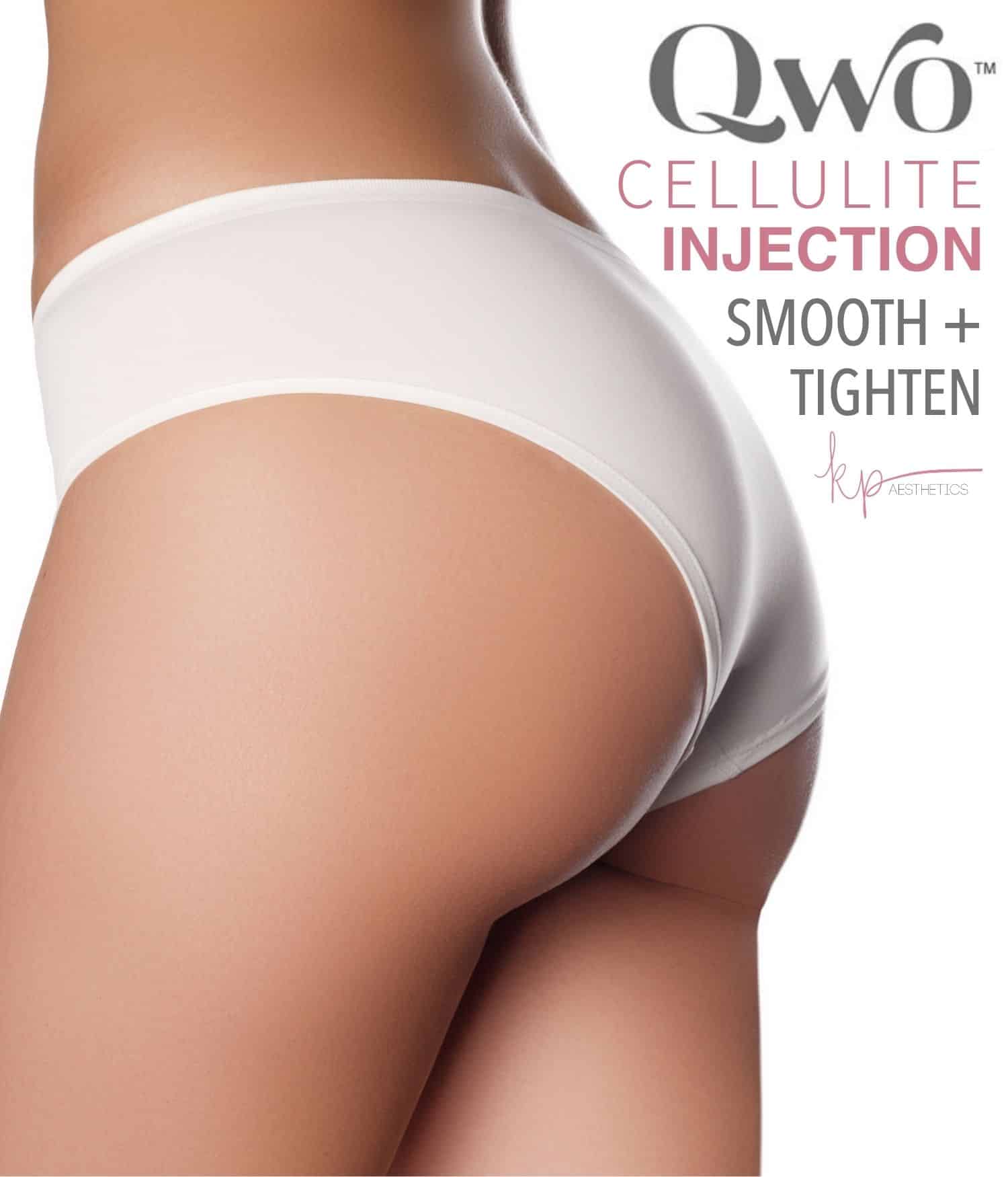 female buttocks without cellulite promoting qwo injectable treatment
