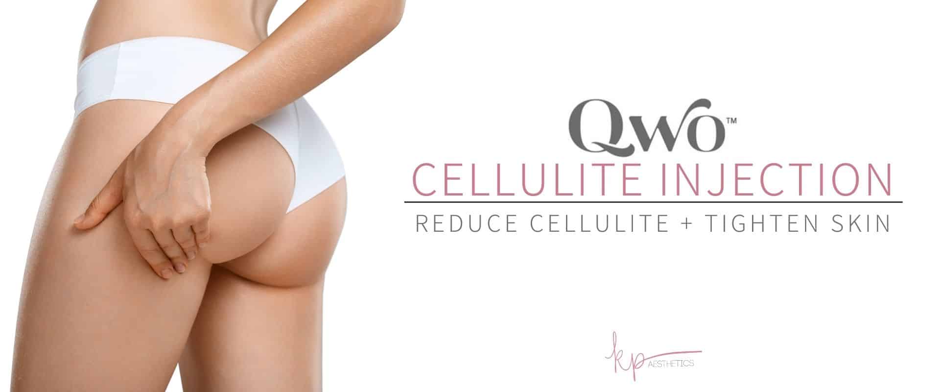 Perfect female buttocks without cellulite after qwo injectable treatment