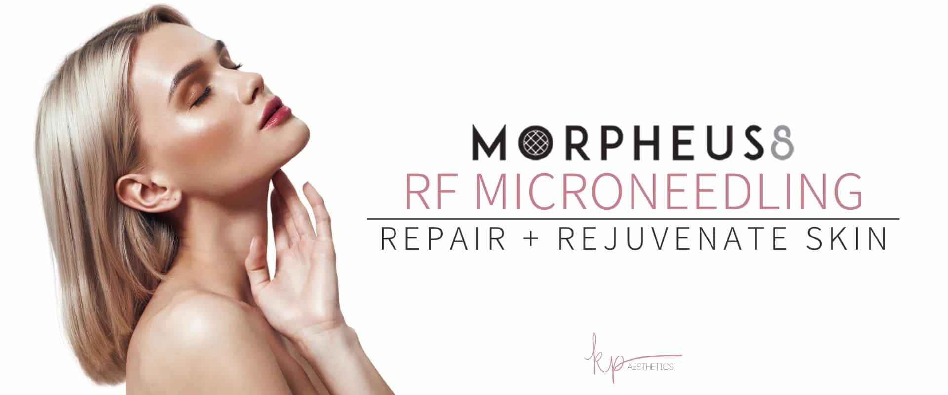 Portrait of a beautiful young woman after Morpheus8 treatment