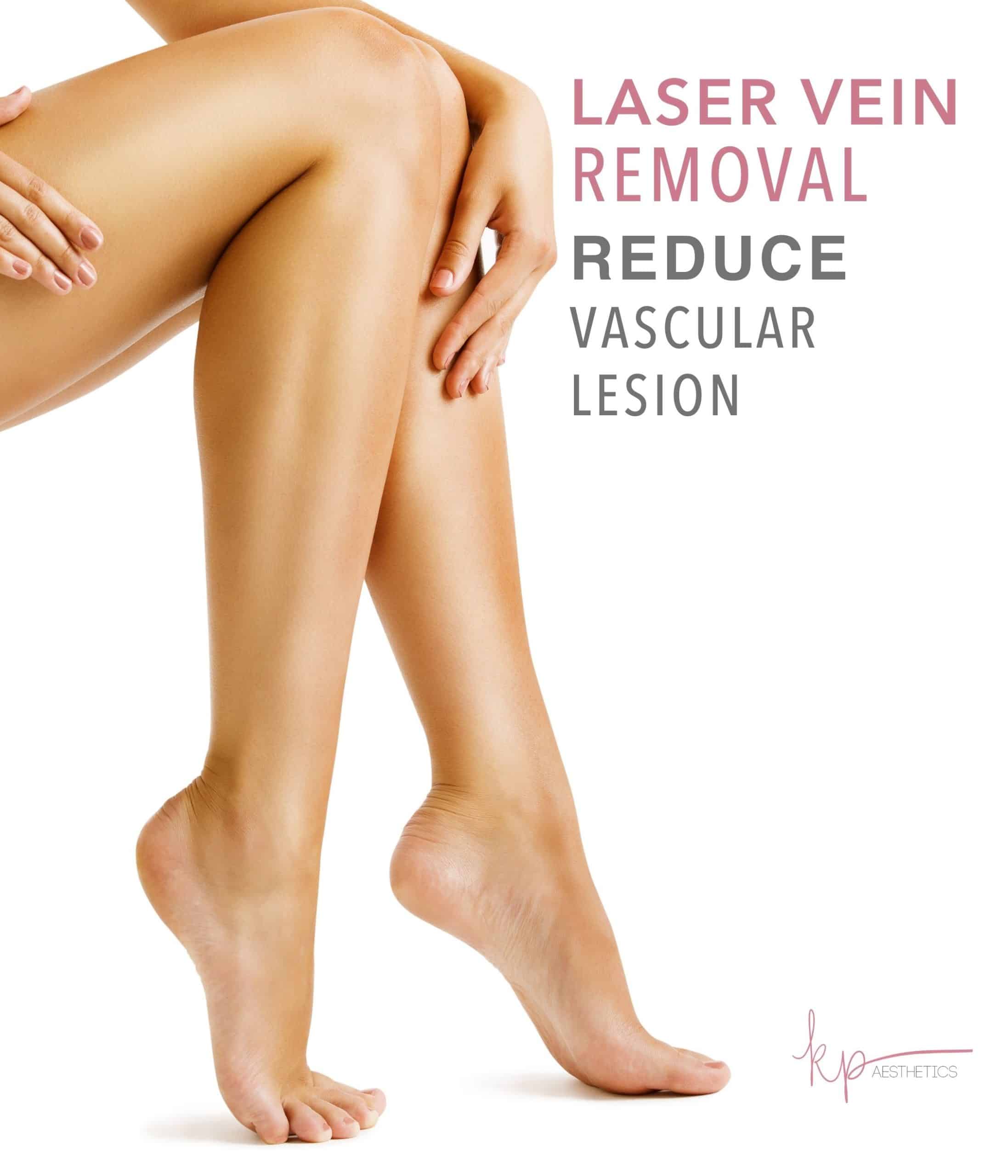 woman with beautiful and clear legs