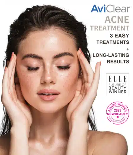 AviClear - Acne Treatment - 3 Easy Treatments + Long-lasting Results - KP Aesthetics