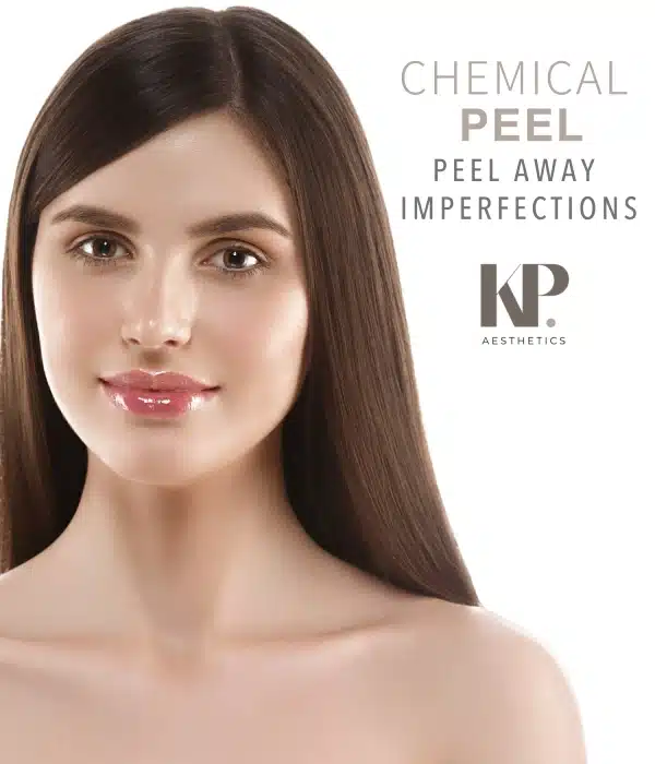 Chemical Peel - Peel Away Imperfections - KP Aesthetics