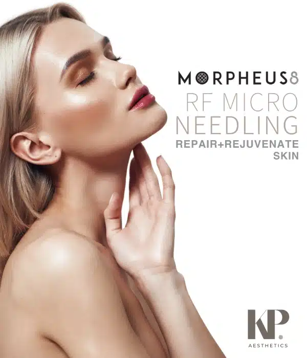 Morpheus8 RF Microneedling - Repair + Rejuvenate Skin - KP Aesthetics